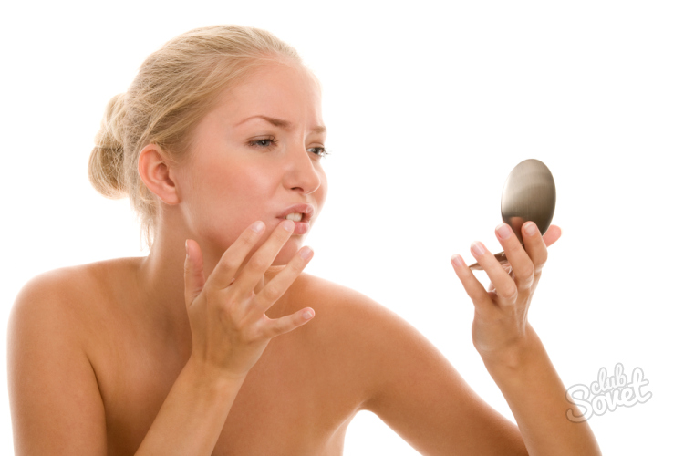 При контакте не заразился герпесом