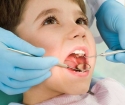 Как лечат зубы детям