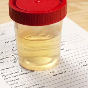 Hur man donerar en pott såning urin