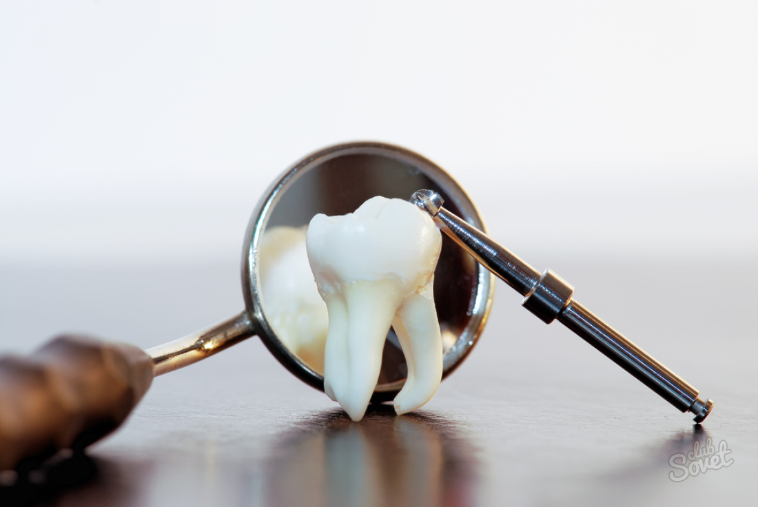 دندان بازنشسته چیست؟