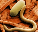 Sinais de parasitas no corpo