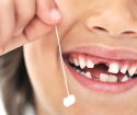 Comment arrêter sa saignement après avoir retiré la dent