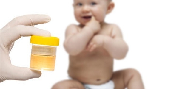 Как да се събират урината при новородени
