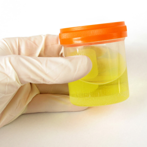 Come raccogliere l'urina quotidiana per l'analisi?
