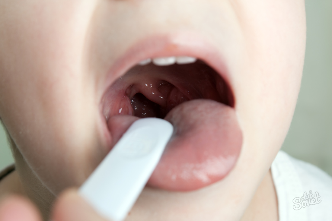 Cum de a elimina mucusul de la gât