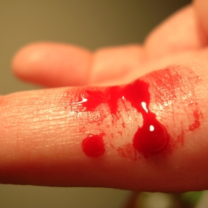 Фото как отстирать кровь с одежды