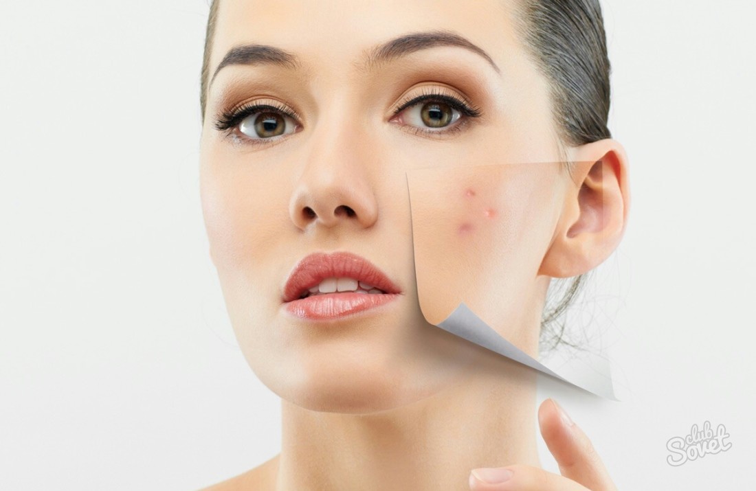 How to quickly remove acne from the face