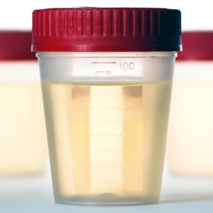 Hur samlar du urin i Nechiporenko