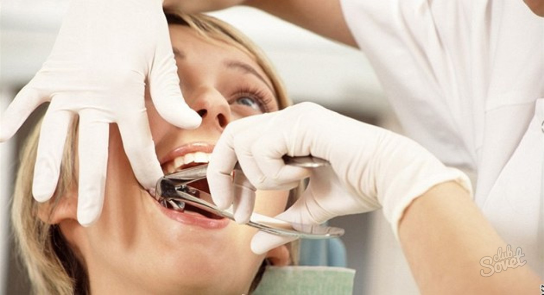 Jak zmírnit bolest po extrakci zubů