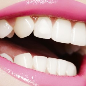 Photo how to align your teeth
