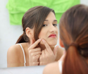 Come curare l'acne sottocutanea