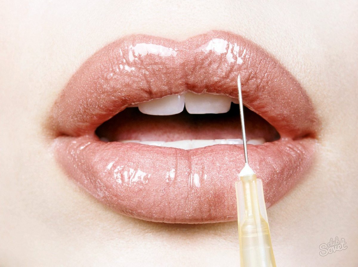 Come rendere labbra carnose