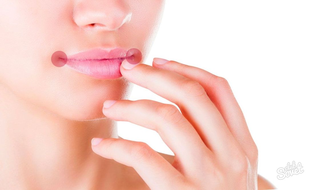 Jak pozbyć przekąski w kącikach ust