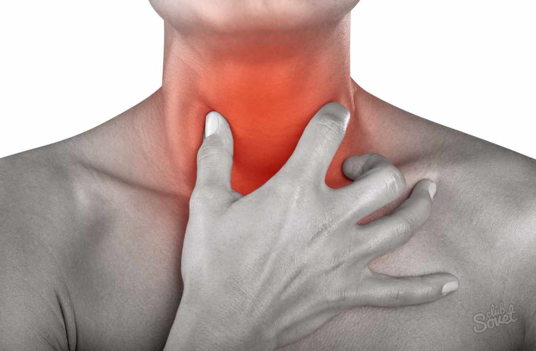 Kako ublažiti boleče grlo