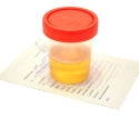 Como coletar análise comum de urina