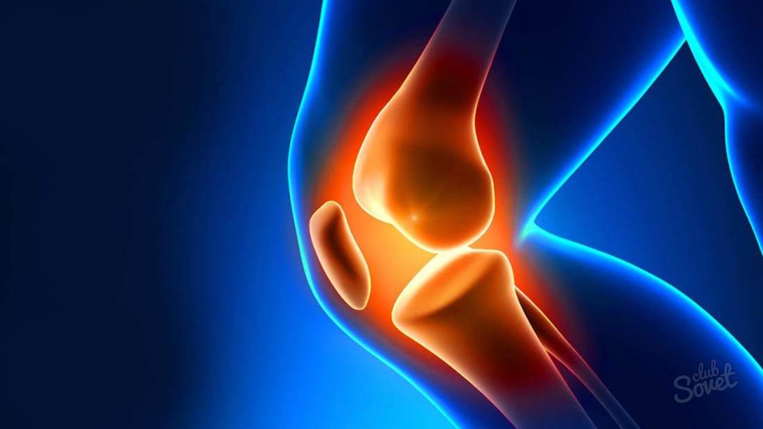 Co je to artritida?