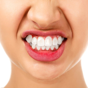 Bruxism: Causes and Treatment