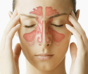 How to cure sinusitis at home