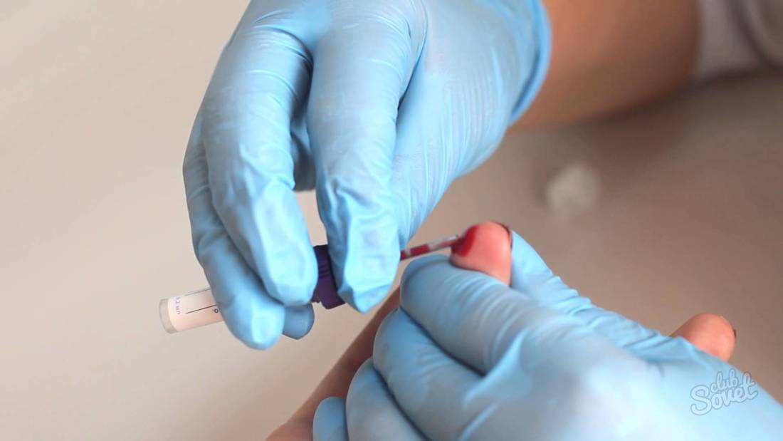 Što pokazuje opći test krvi