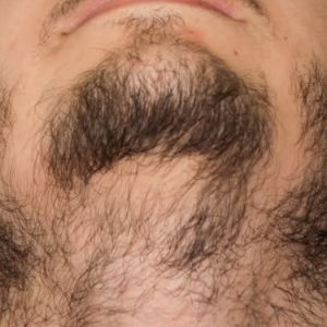 Wie man einen Bart wächst, wenn es nicht wächst