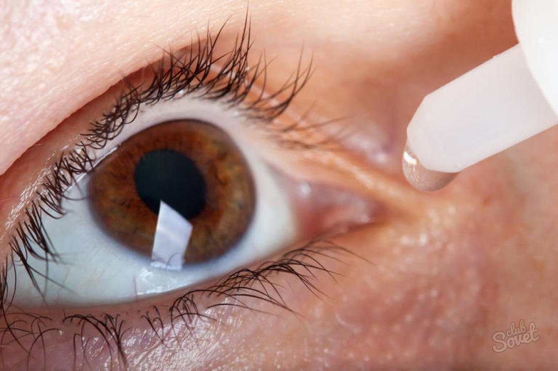 كيفية حفر قطرات في العين