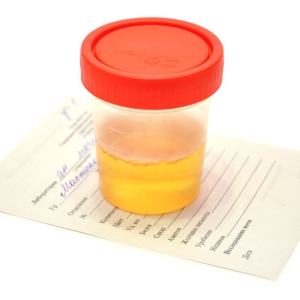 Como coletar uma análise de urina geral
