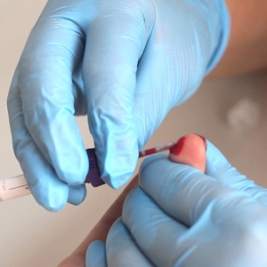 Foto čo ukazuje všeobecný krvný test