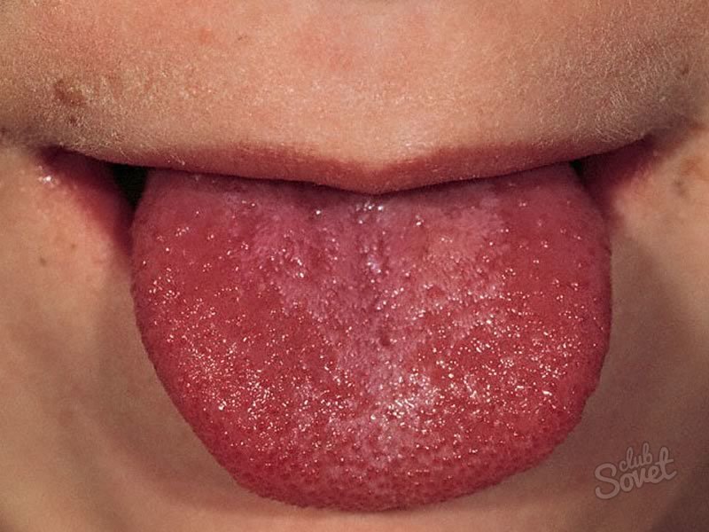 Eruzione cutanea nella bocca di un bambino cosa fare