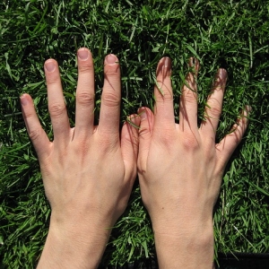 Stock Foto Cones on fingers hands - hygromy