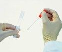 How to take a swab in men