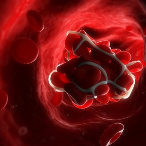 Foto Ako redukovať hemoglobín v krvi