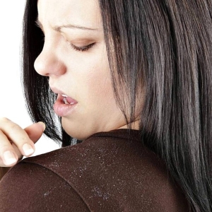Photo how to get rid of dandruff on the head