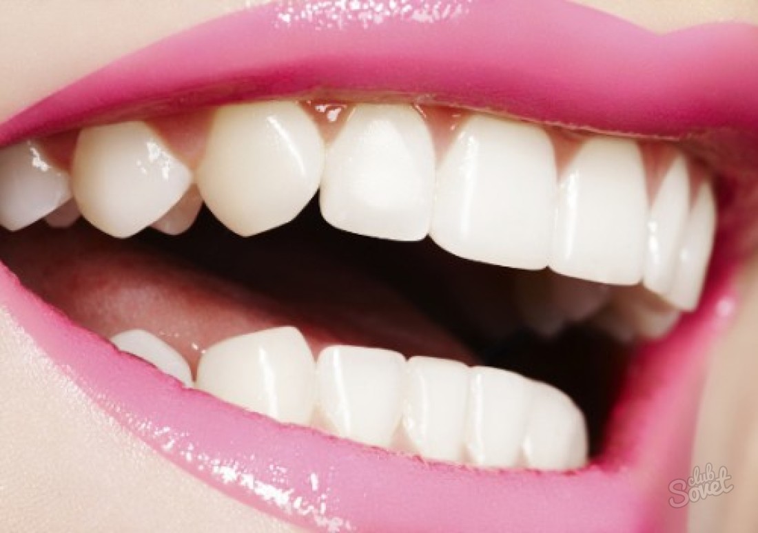 How to align your teeth