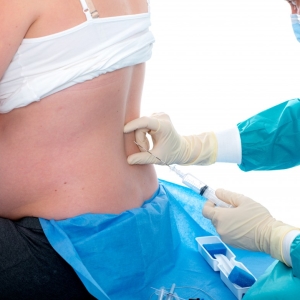 Stock Foto epidural anestesi i förlossning