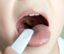 Cum să îndepărtați mucusul din gât