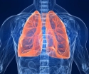 Que traiter la bronchite