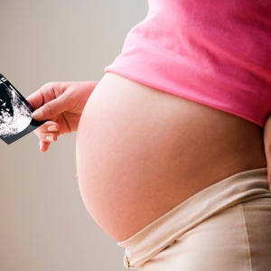 Photo À quelle fréquence puis-je faire des ultrasons pendant la grossesse