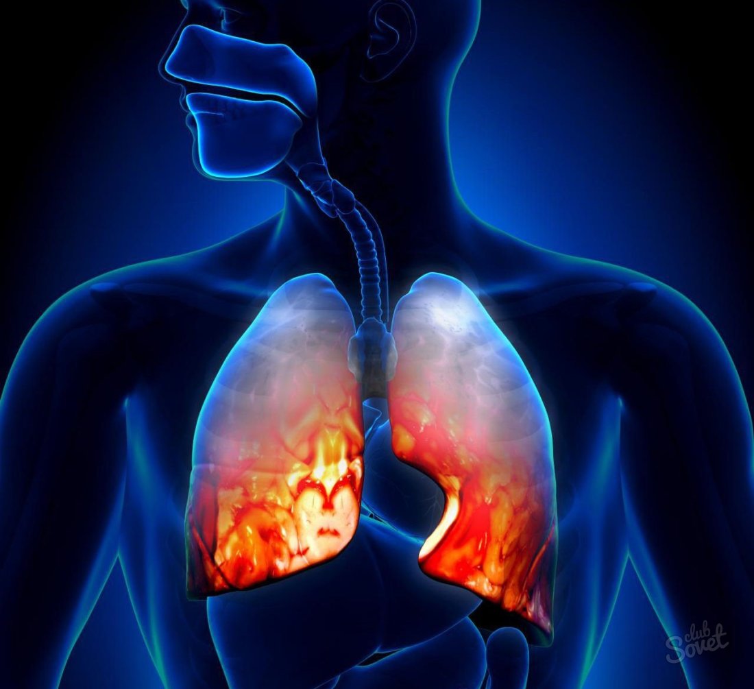 Pullure белите дробове - симптоми и лечение