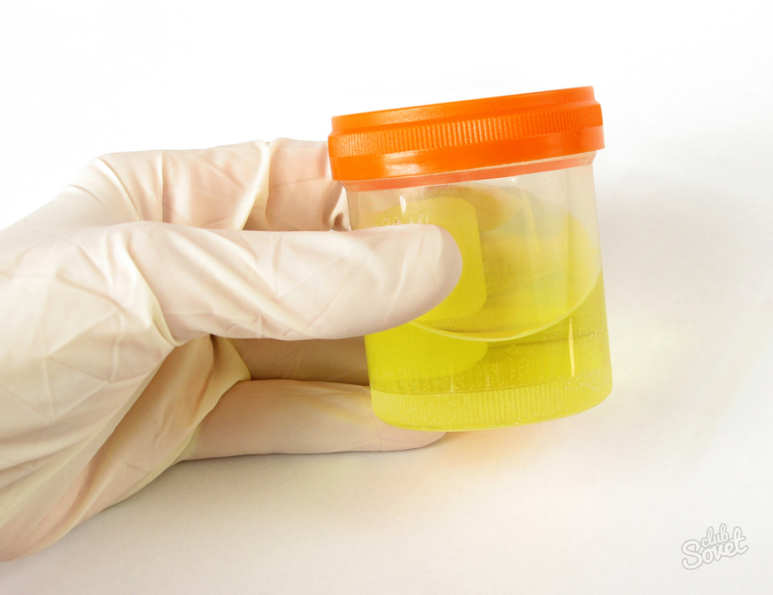 Cum se colectează urina zilnică pentru analiză?