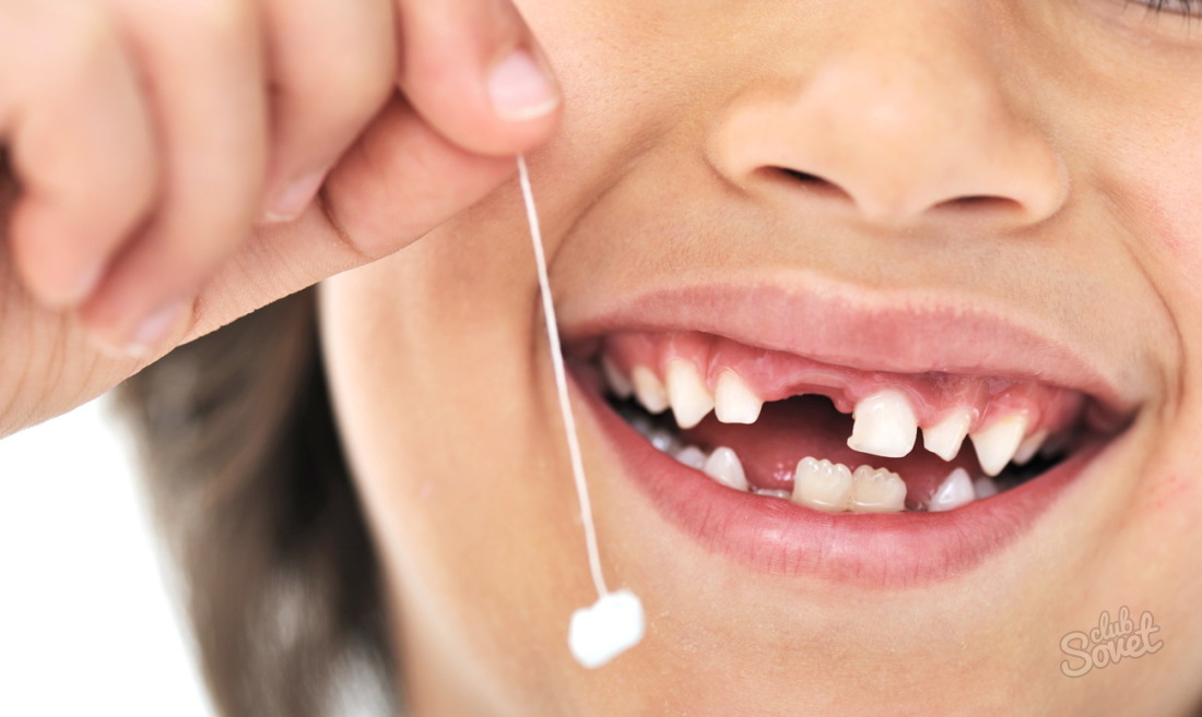 Jak przestać krwawić po usunięciu zęba