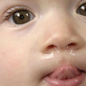 Photo runny nose in infants - how to treat