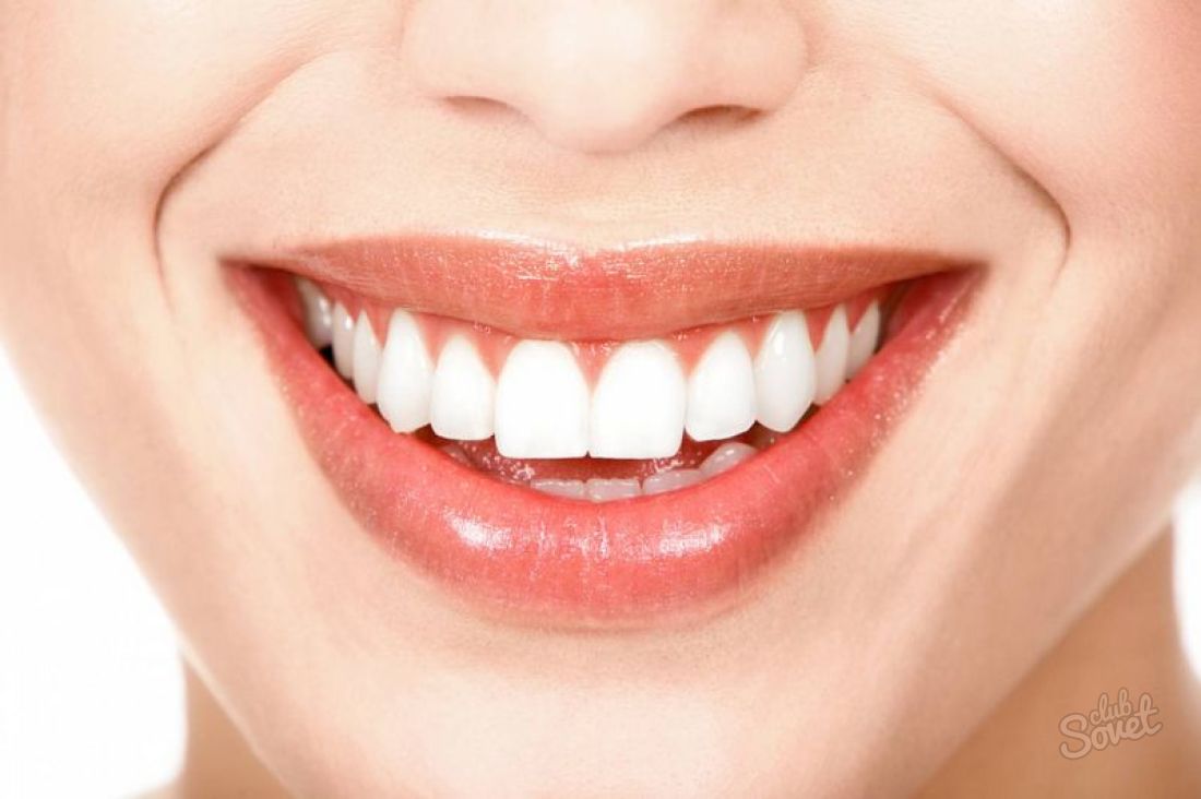 Wie man deine Zähne ohne Schaden aufhellt