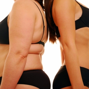 Photo How to remove fat from the back