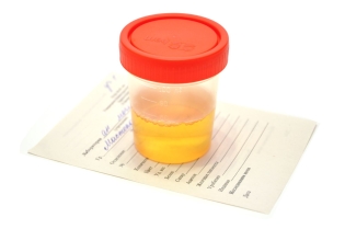 Come raccogliere analisi comune delle urine