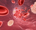 Hur man ökar leukocyter