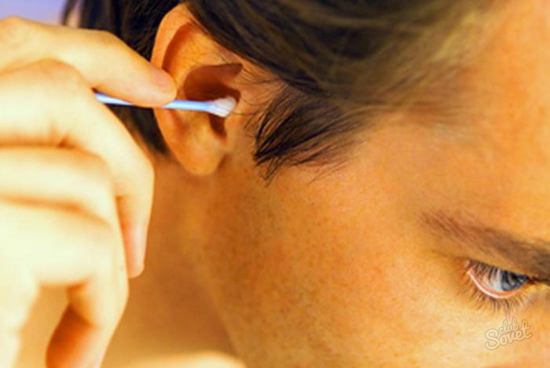 Как лечить грибок в ушах