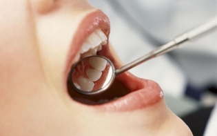 Hur man kan bli av dentala sten
