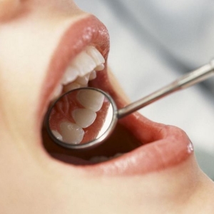 عکس چگونه از سنگ دندانپزشکی خلاص شود