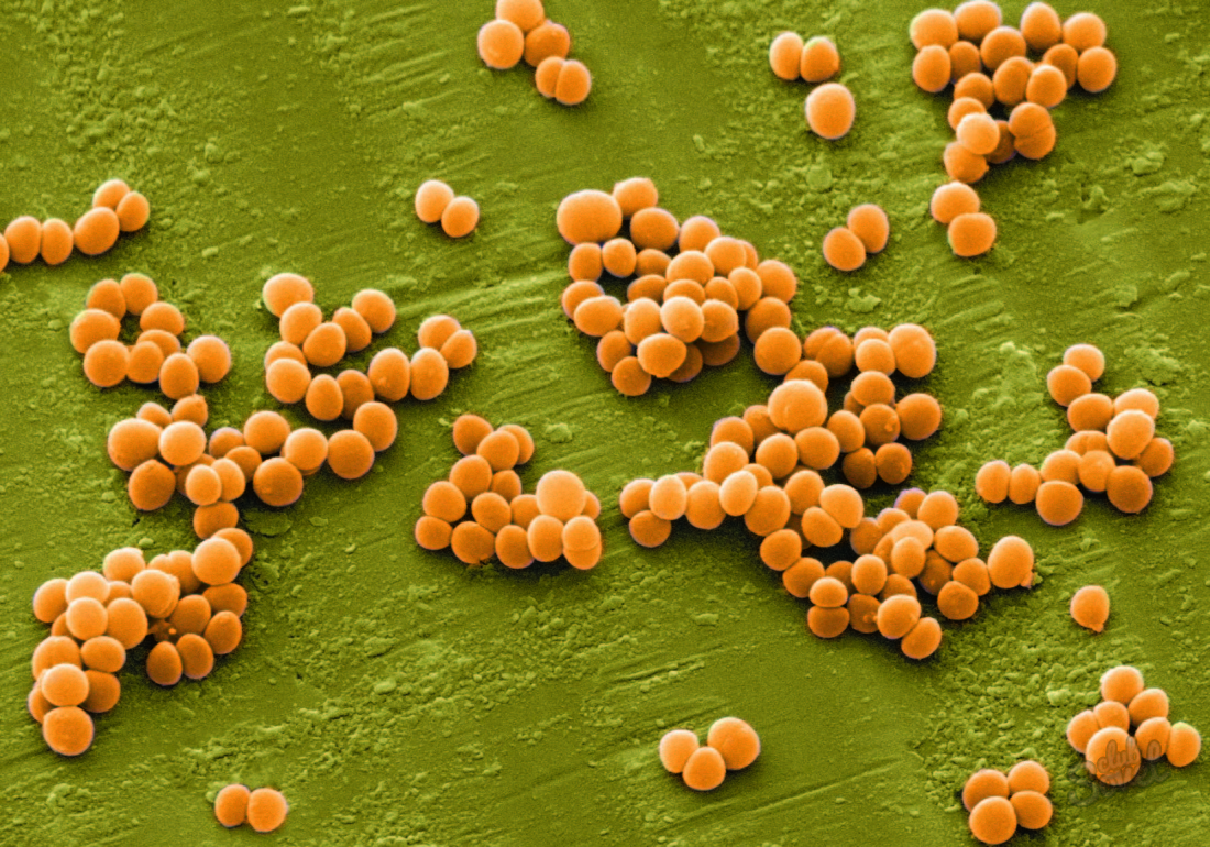 Hur man botar Staphylococcus