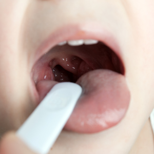 Come rimuovere il muco dalla gola